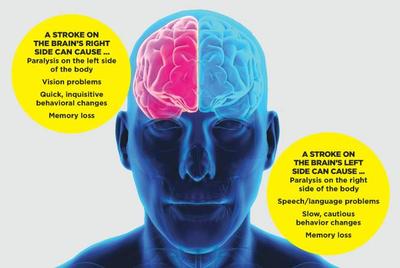 What Is Life Like After A Stroke Rehabilitation And Recovery Following A Stroke Sunrise Hospital