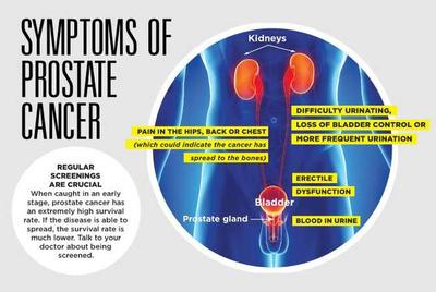 Prostate Cancer And The Importance Of Early Detection Sunrise Hospital