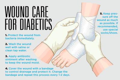 Caring For Wounds And Foot Ulcers In Diabetic Patients Sunrise