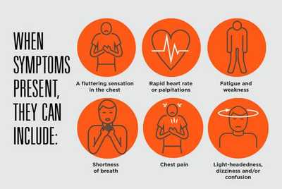 Atrial Fibrillation: You May Have It and Not Know It | Sunrise Hospital